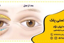 Who is the best plastic eye surgeon in Isfahan?