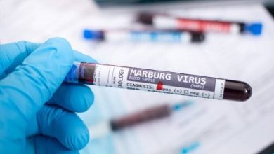 The result of the examination of the Spanish patient suspected of having "Marburg" was negative